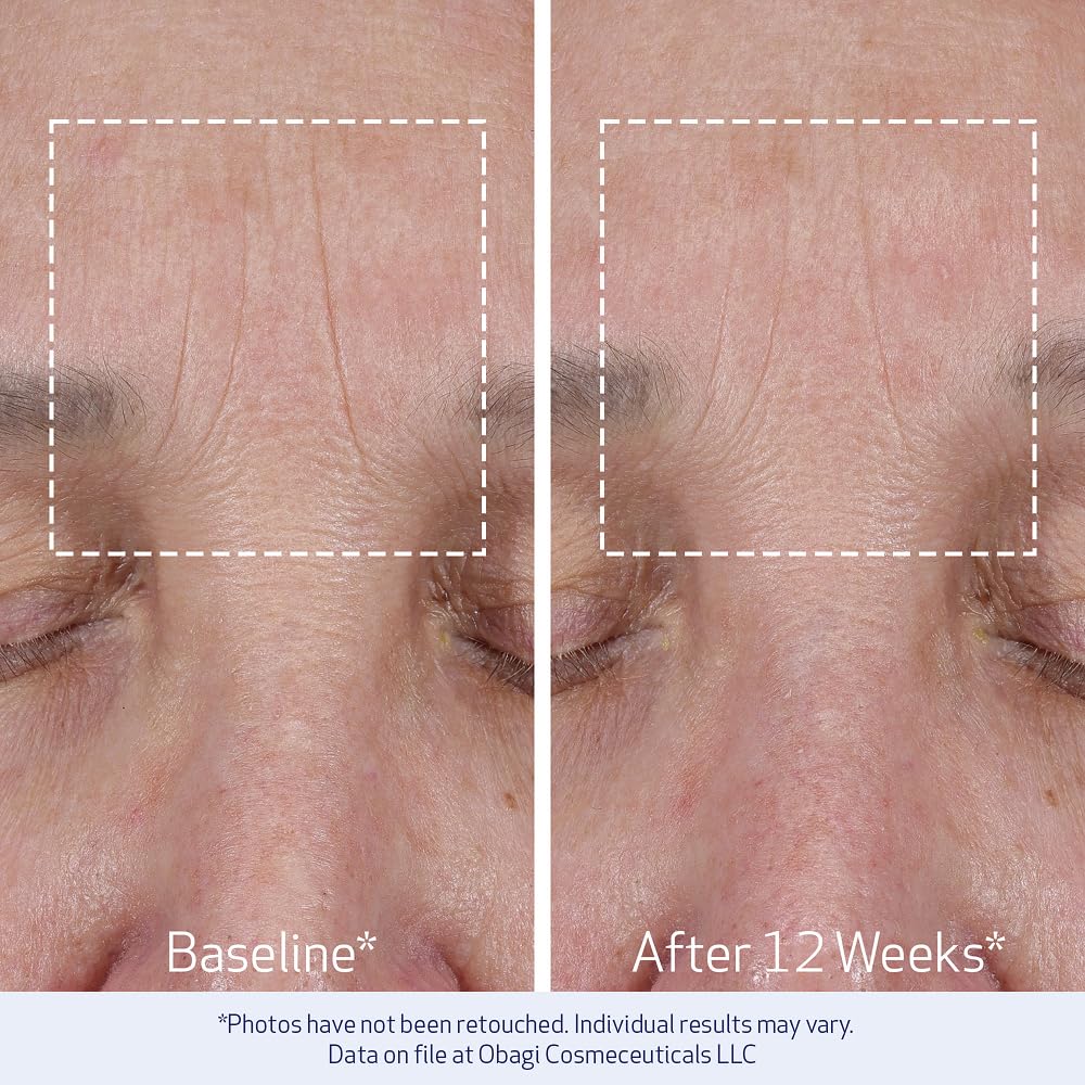 Obagi ELASTIderm Lift Up &amp; Sculpt - Crema facial antienvejecimi...