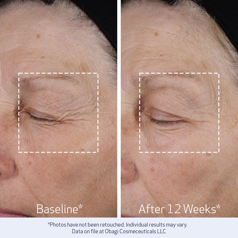 Obagi ELASTIderm Lift Up &amp; Sculpt - Crema facial antienvejecimi...