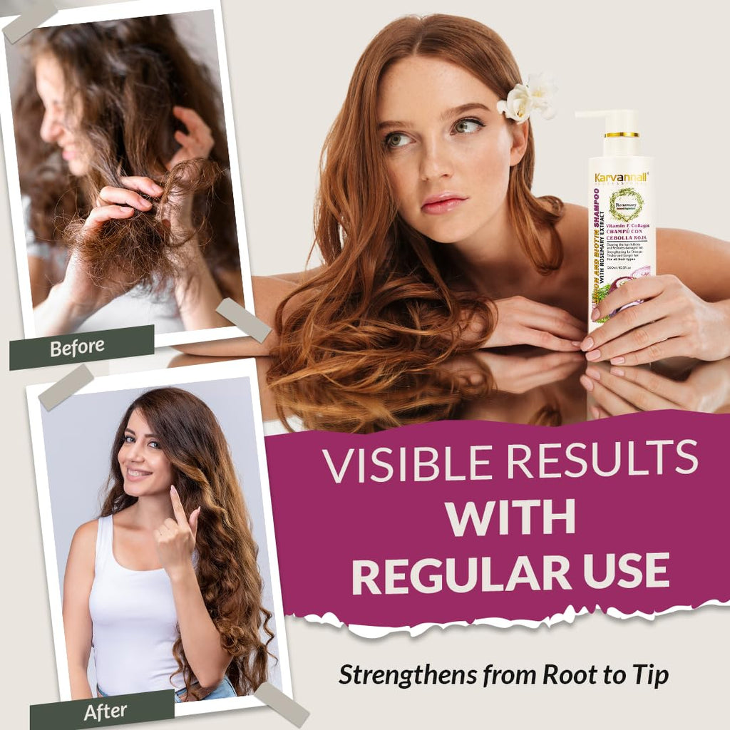 Rosemary Biotin Shampoo &amp; Hair Mask Set | Extracto de cebolla,...