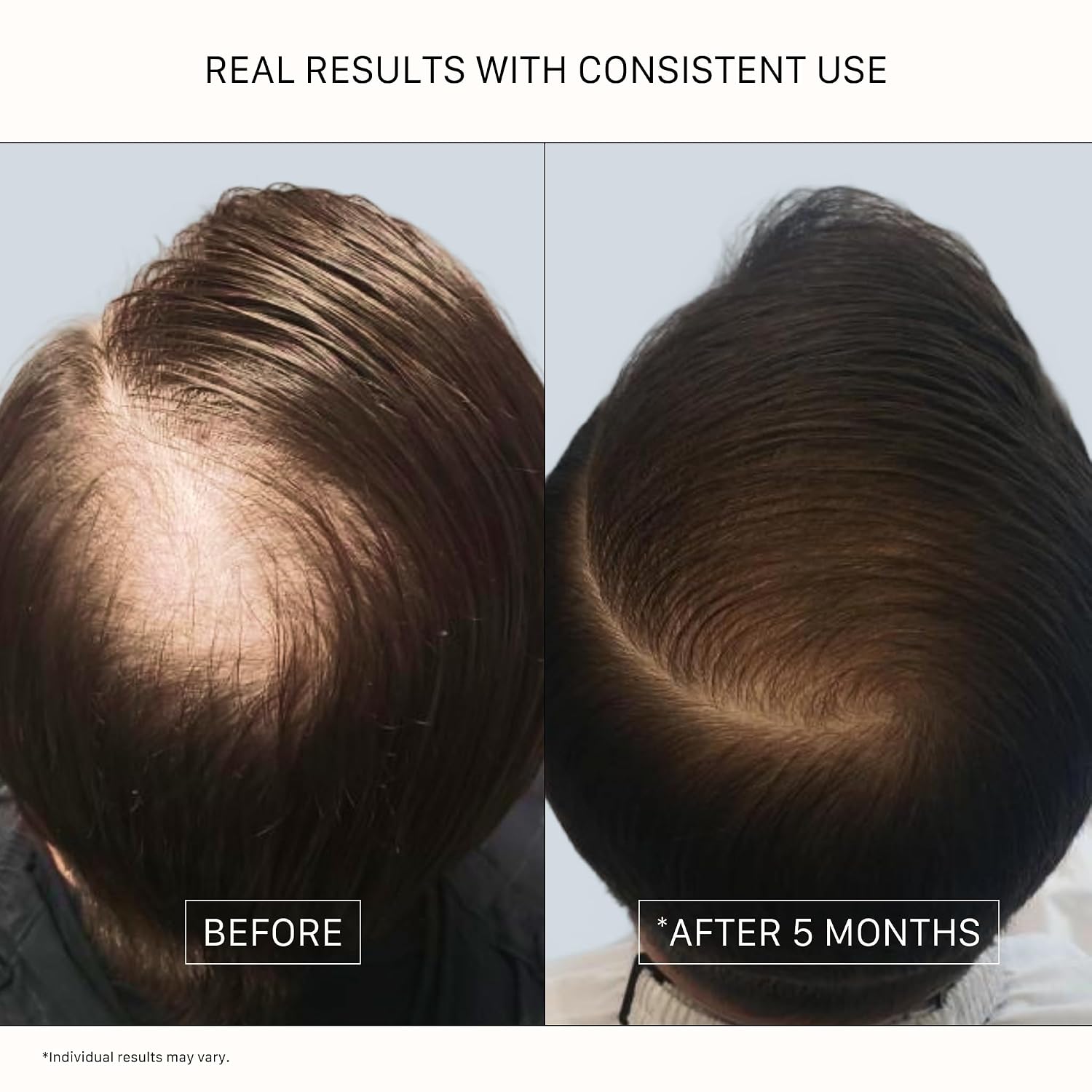 ACTIIV Recover - Tratamiento de champú engrosante para hombres | Ap...