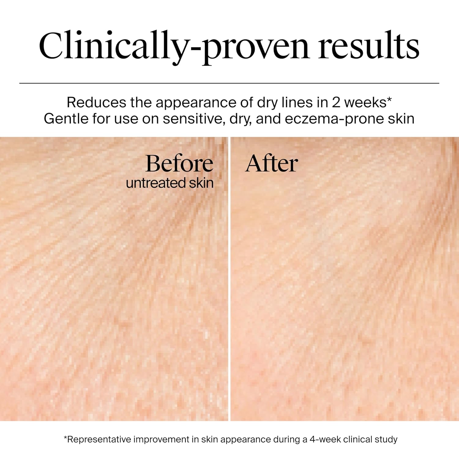Neutrogena Hydro Boost Gel Cream, hidratación de 48 horas para piel...