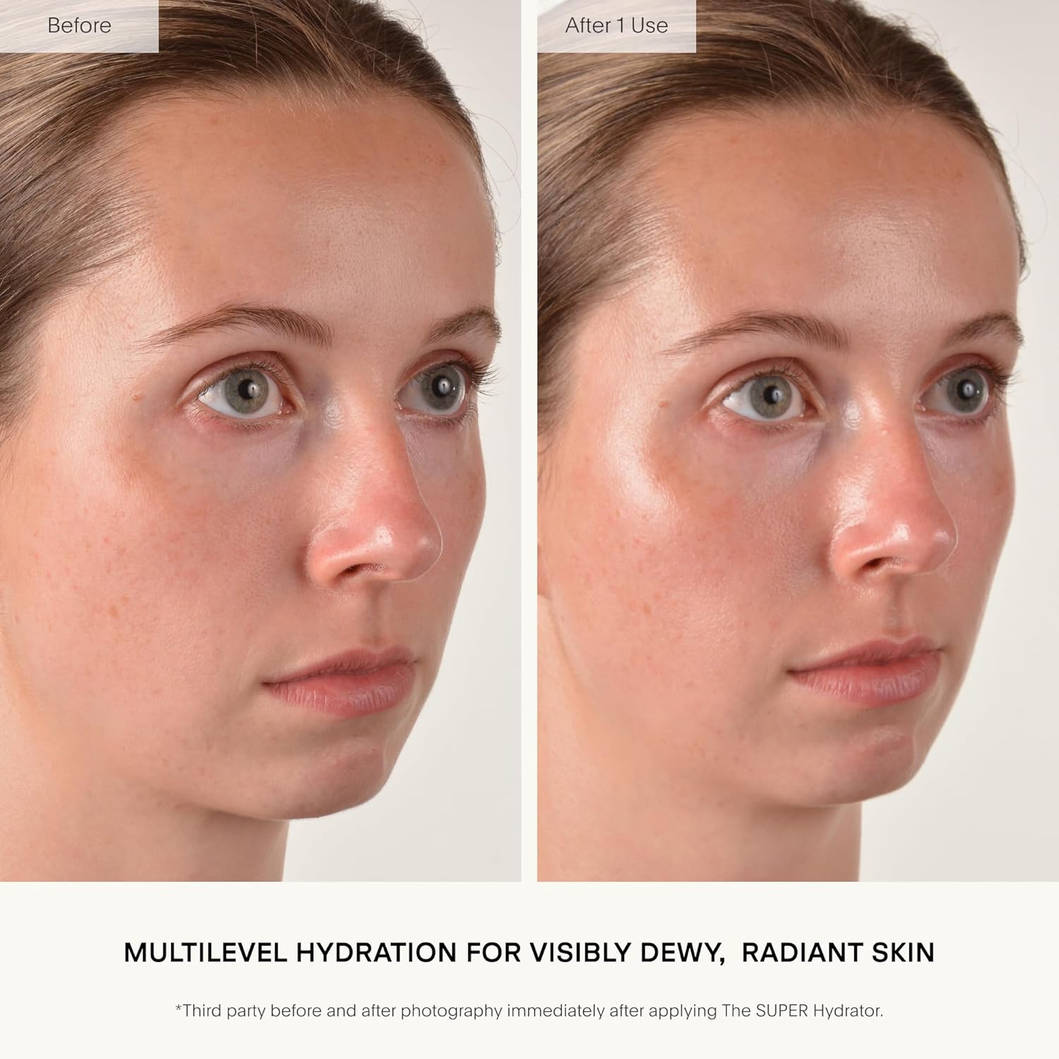 U Beauty The SUPER Hydrator - Hidratante de Piel de Megadosis y Cre...