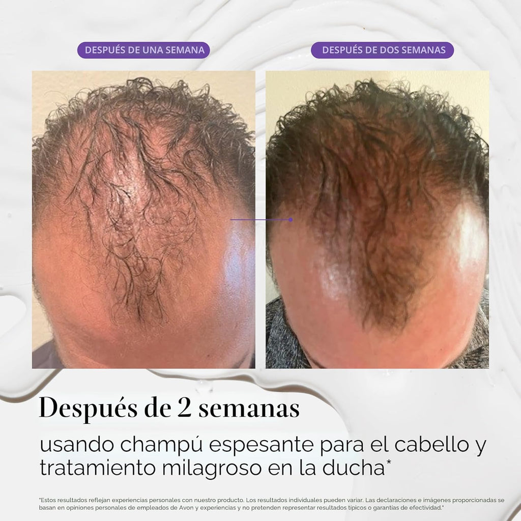 Dr. Groot Miracle in Shower - Tratamiento hidratante para la pérdid...