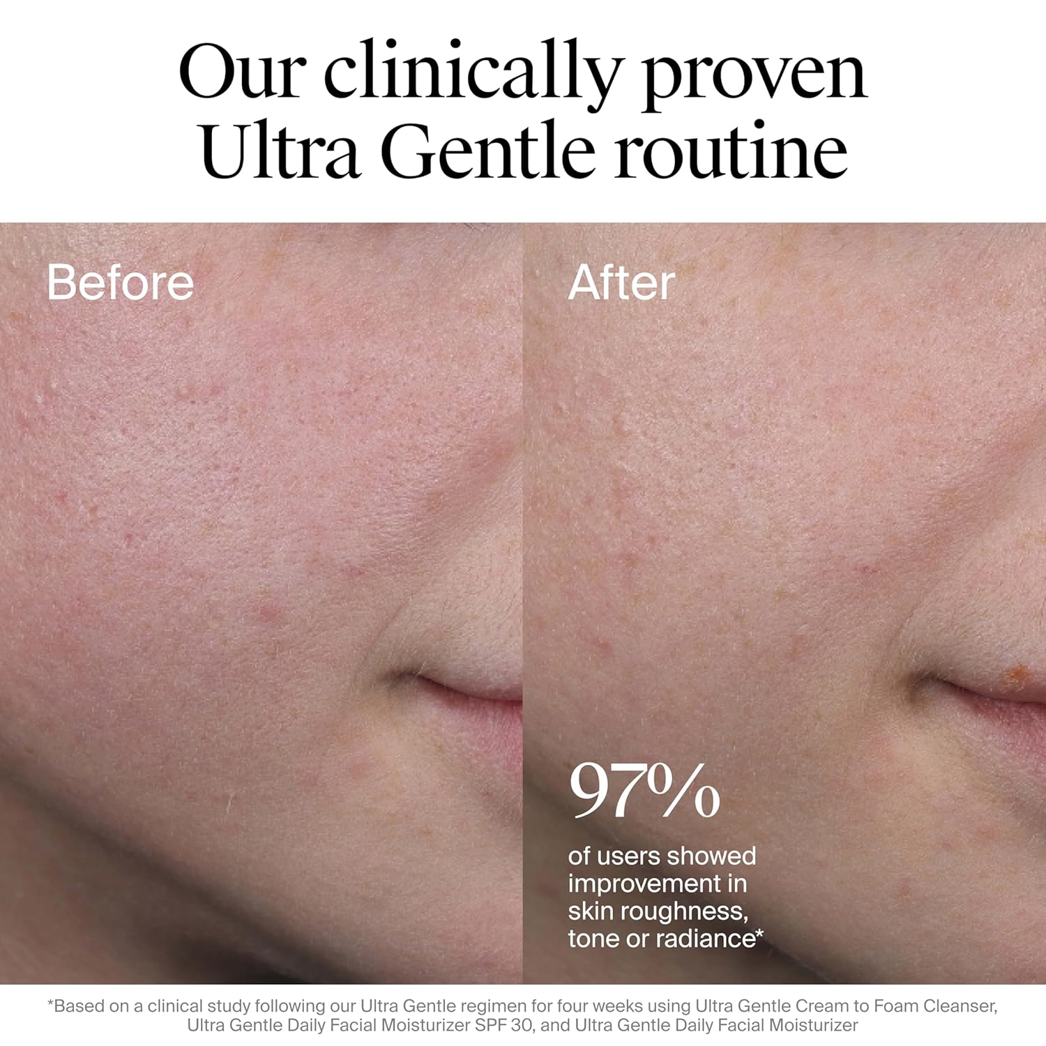 Neutrogena Hidratante facial diario sin fragancia, hidratante facia...