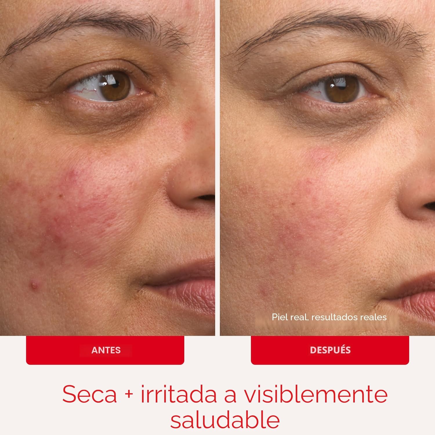 Crema ultra reparadora First Aid Beauty, hidratante facial y corpor...