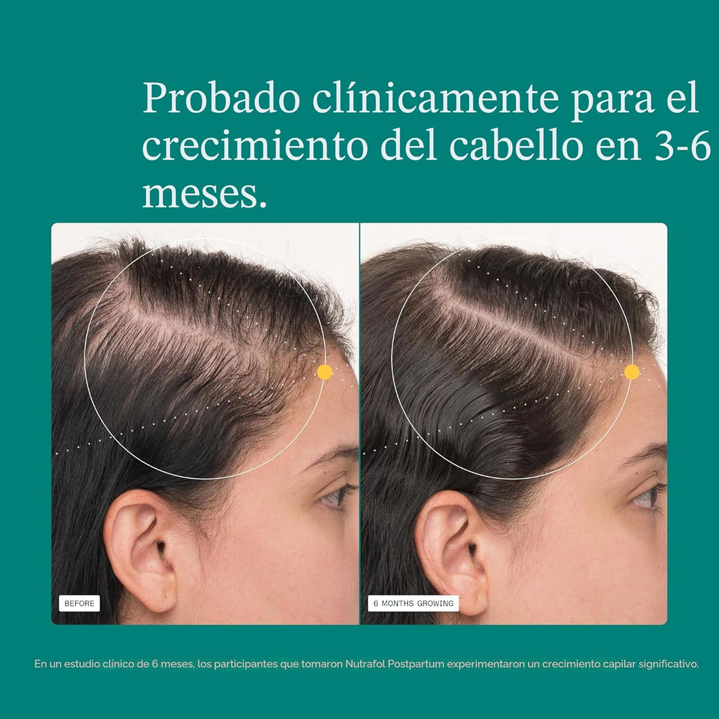 Suplemento para el crecimiento del cabello posparto Nutrafol