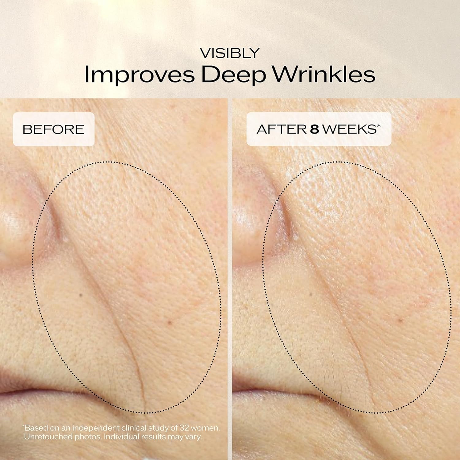 Shiseido Vital Perfection Crema Avanzada Edificante y Reafirmante -...